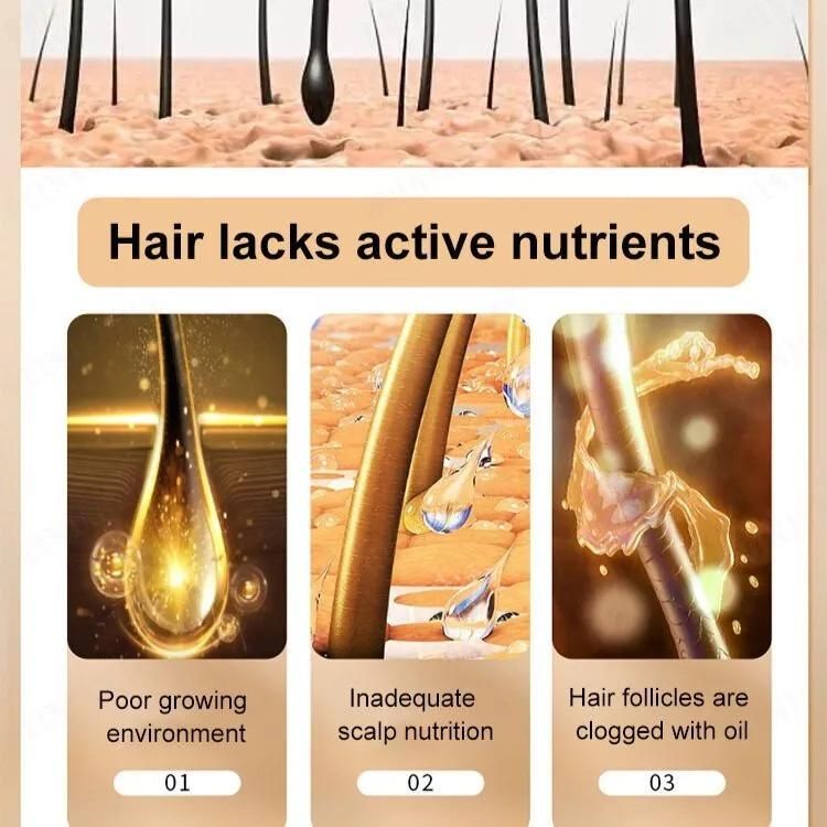 Anti Hair Loss Shampoo – Pack of 2 (600ml Total) for Hair Growth & Dandruff Control